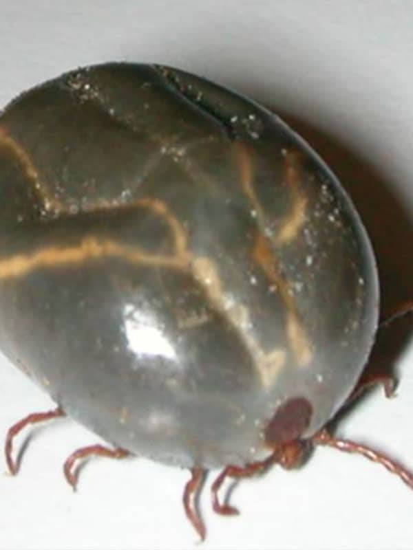 Warning Issued After New Tick Species Discovered In Westchester
