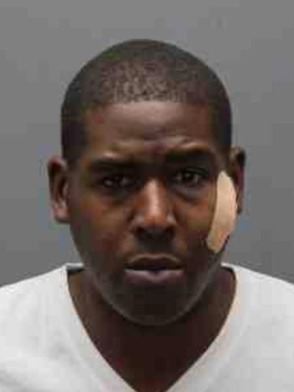Bite To The Face In Yonkers Leads To Life In Prison For Armed Robber