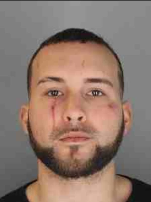 Complaints Of Drug Activity Lead To Arrest Of 20-Year-Old In Tarrytown