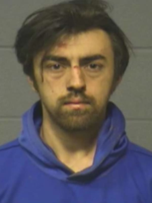 21-Year-Old Accused Of Stabbing Two Fellow Students During University Of Hartford Class Project
