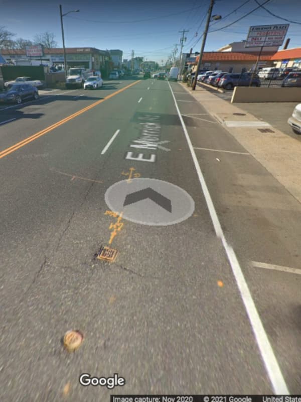 Man Seriously Injured After Being Struck By Car On Long Island Roadway