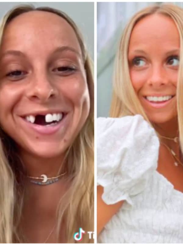 Dating With Dentures: NJ TikTok Star Finds Reasons To Smile