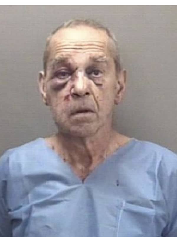 66-Year-Old Milford Man Charged After Stabbing Victim Multiple Times, Police Say