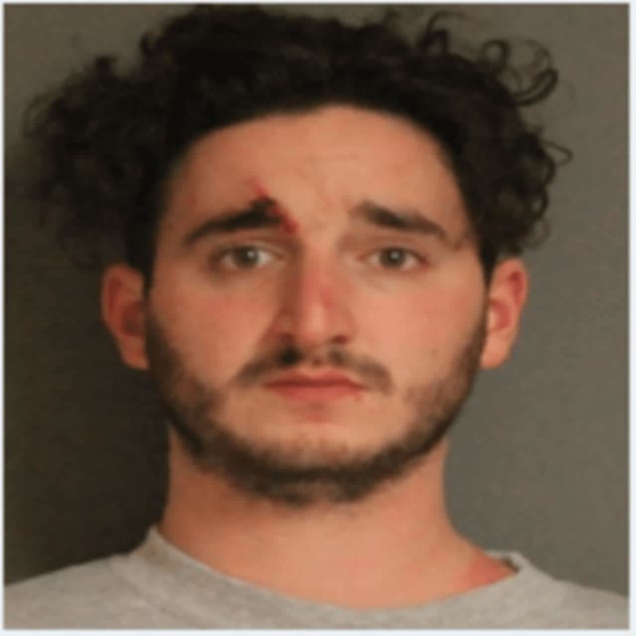 Zachary Tokson pleaded guilty to three felony counts after while he was driving the wrong way on I-684 that resulted in the death of a woman.