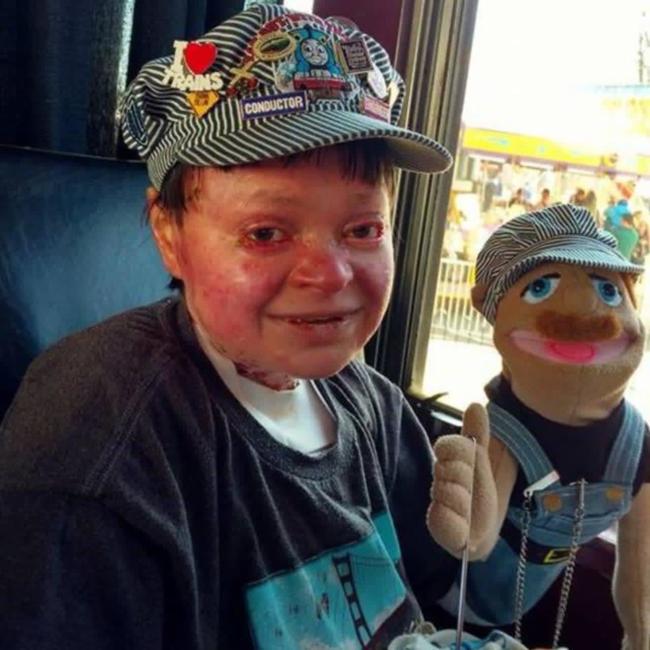 A Connecticut man who spread humor and joy despite suffering from a rare skin disorder has died.