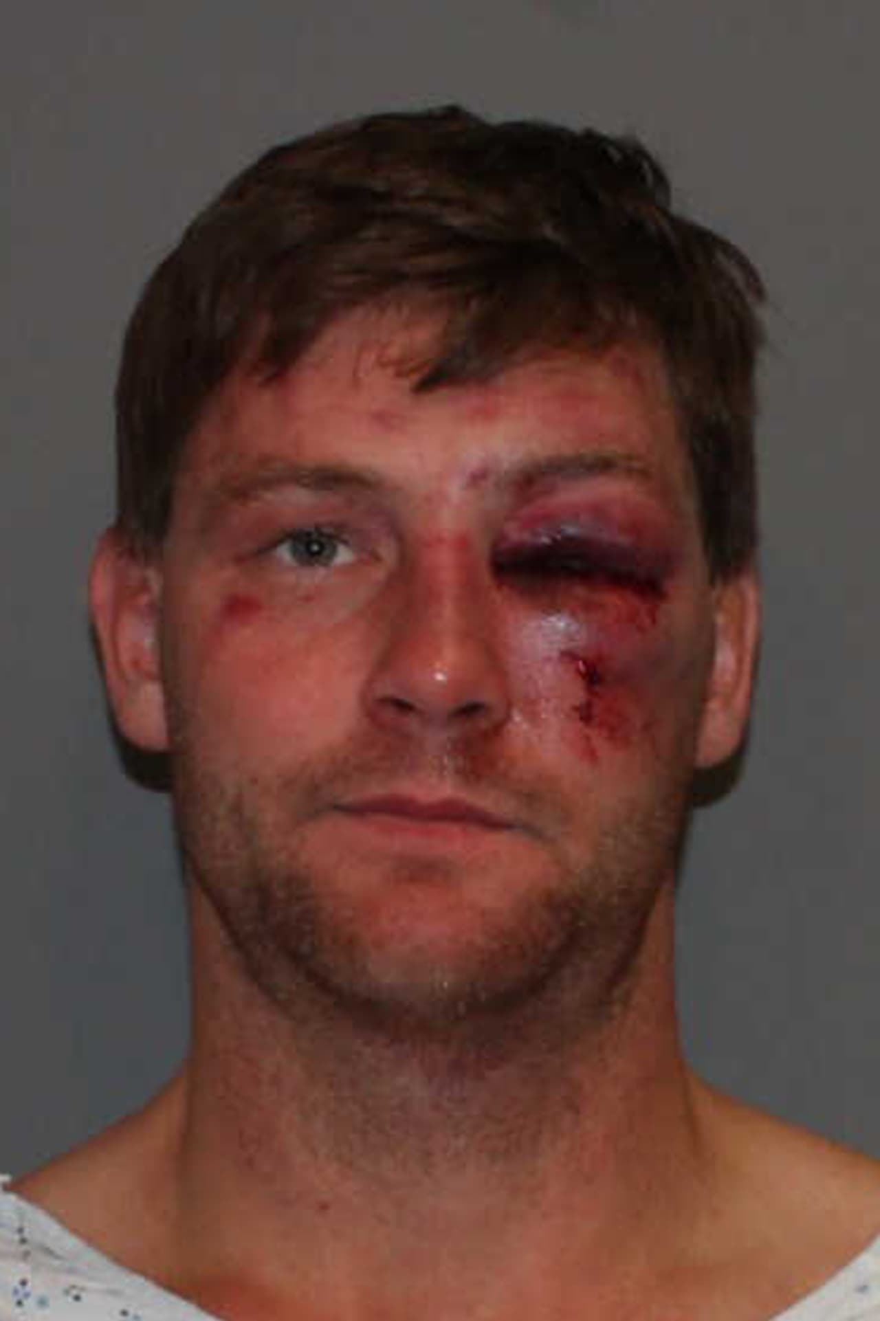 Christian Garnett, 32, was charged with assault on a police officer and driving under the influence Thursday morning by Norwalk Police.