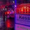Visitor, 68, Injured In Kessler Elevator Accident