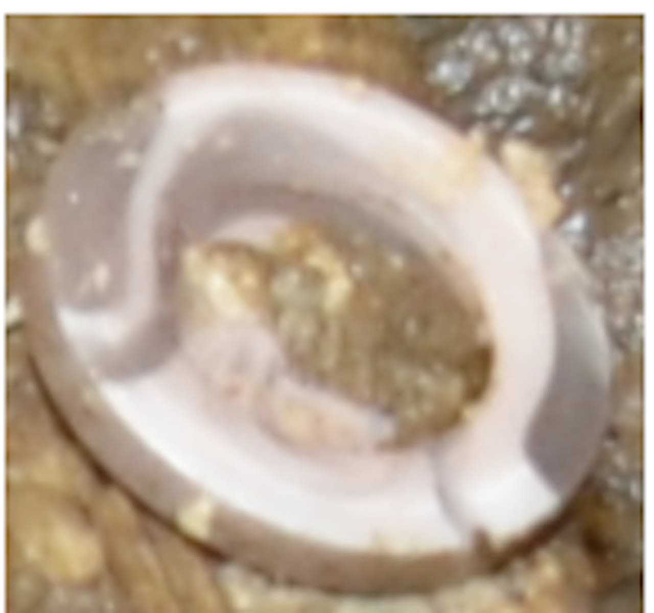 Actual button from sweater of the deceased.