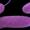 PA Patient Has Deadly Flesh Eating Bacterial Infection, Health Dept. Says
