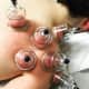DeCicco uses cupping to treat shoulder pain.