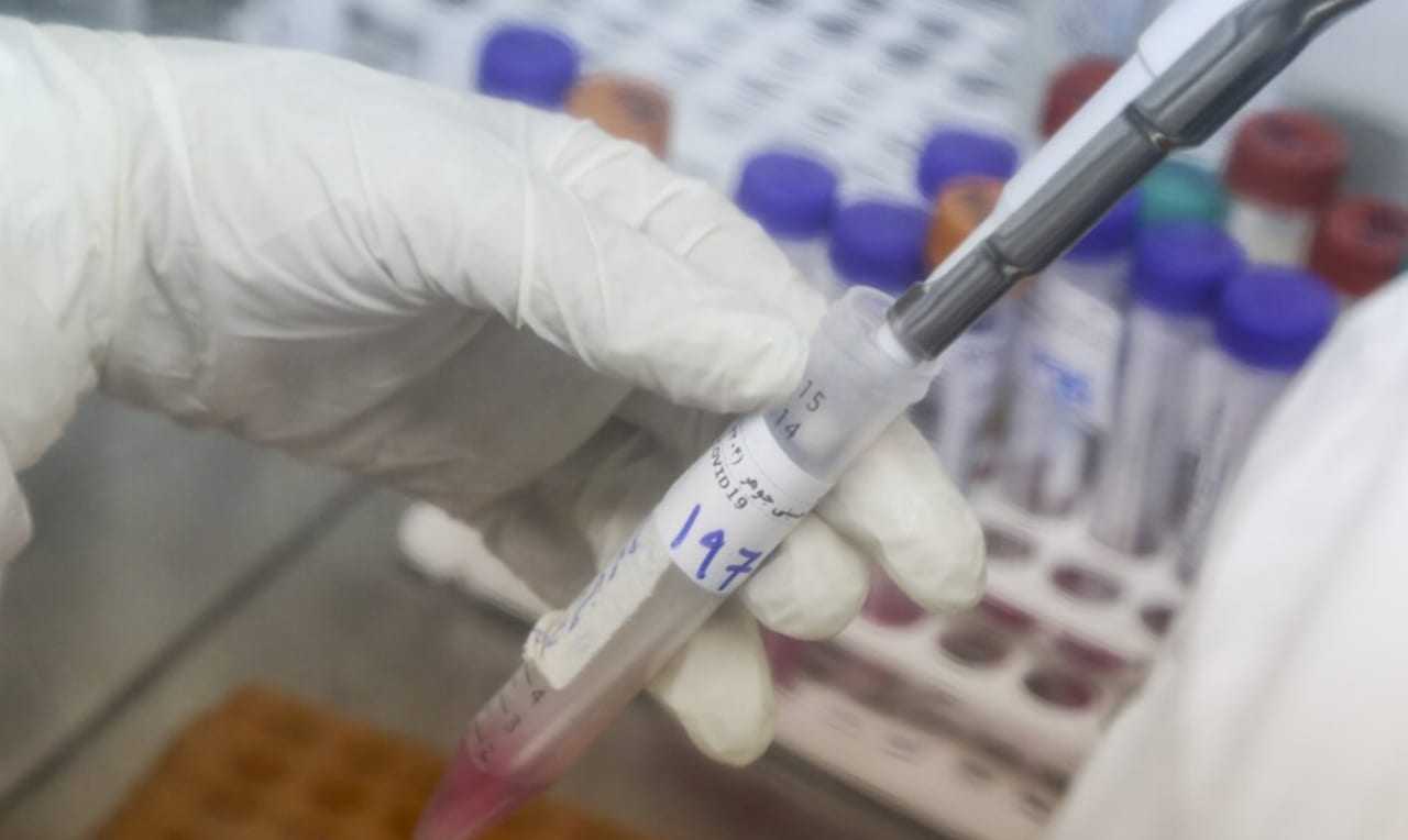 A few Worcester County communities - Brookfield and Sturbridge - that had been seeing a surge in COVID-19 positive test rates have gone done significantly; Worcester is also seeing a decline.