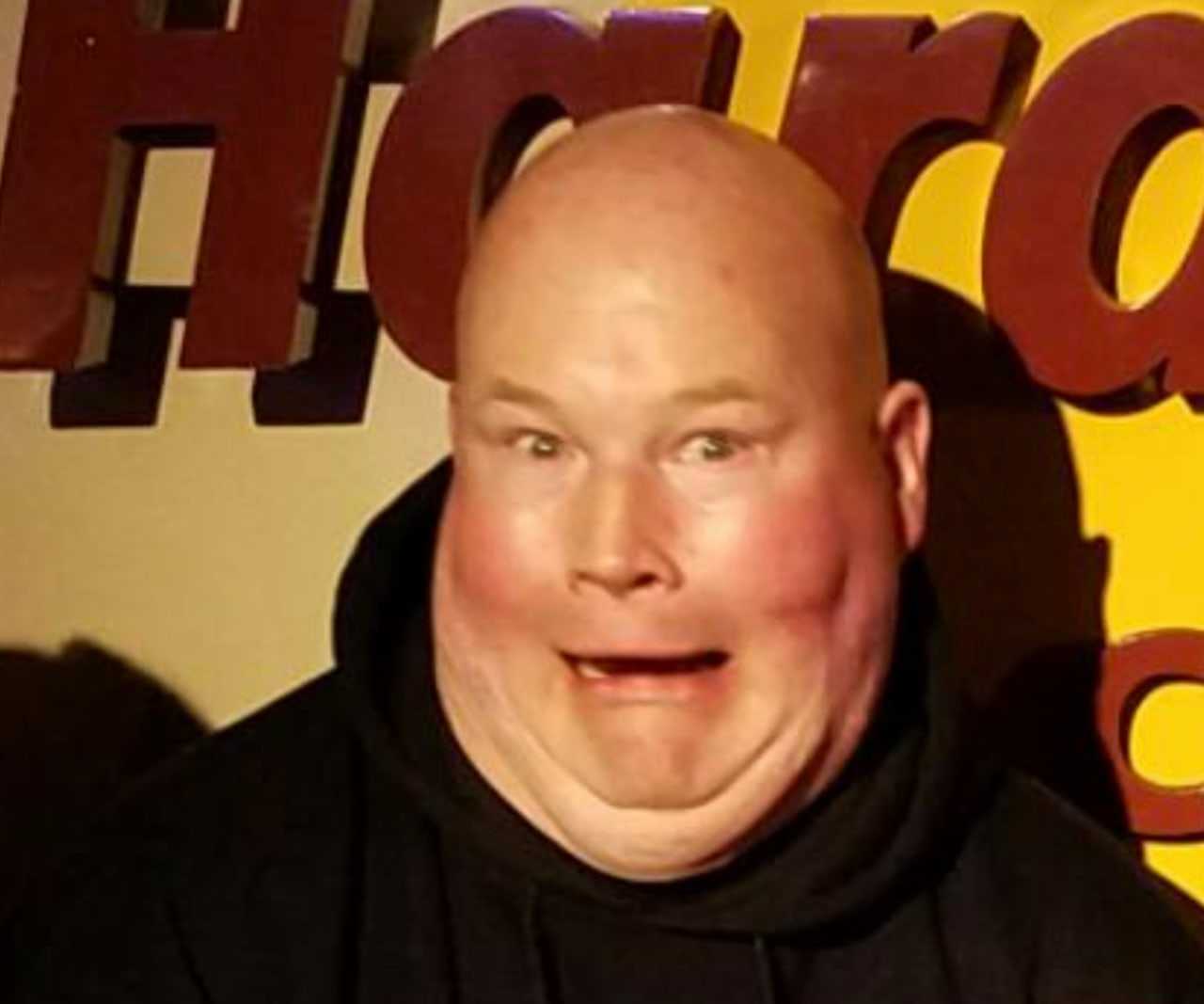 Iconic Competitive Eater Patrick Philbin AKA ‘Pat From Moonachie’ Dies