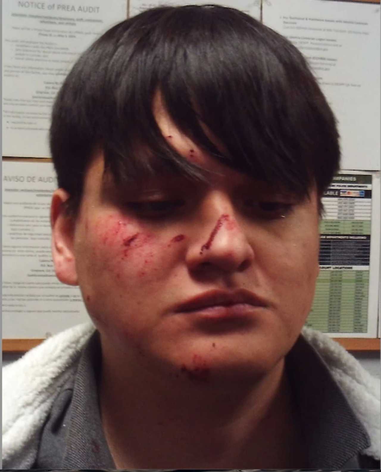 WrongWay Danbury Driver Crashes Into Patrol Cruiser On I84 In Newtown