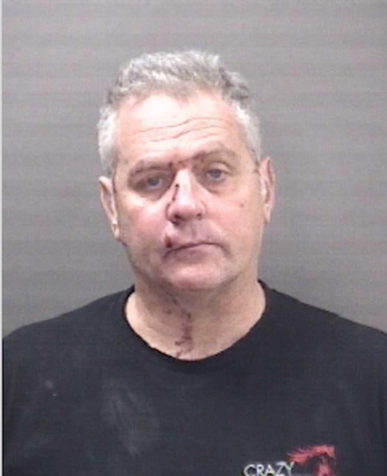 Man Punches Officer In Face At Popular Milford Bar, Police Say New