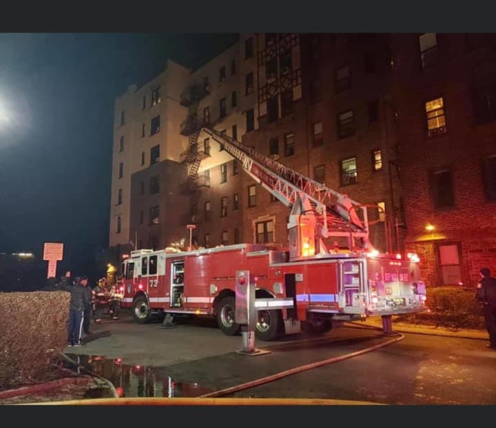 Two residents were burned and two firefighters injured during an apartment fire in Yonkers.