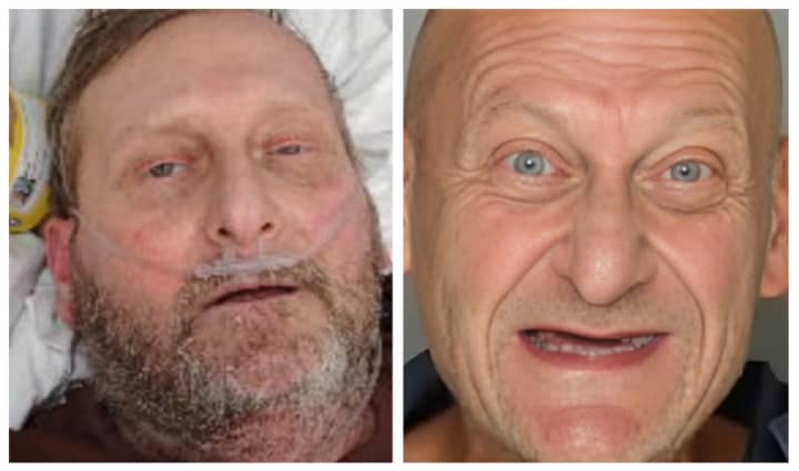On the left is Donald Gene Hess at 8:57 a.m. on Feb. 22, 2024,&nbsp;and on the right is him when he was arrested on June 17, 2023.