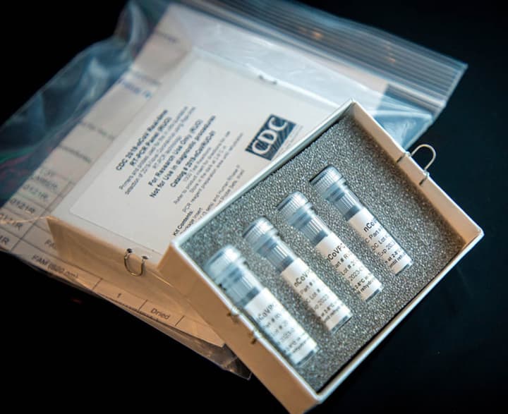 The CDC&#x27;s COVID-19 laboratory test kit