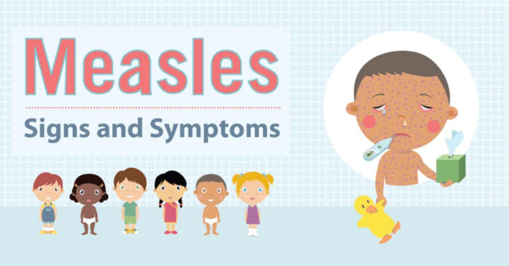 Orange County is reporting six cases of measles.