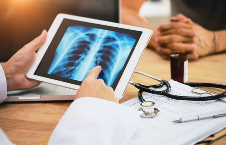 NewYork-Presbyterian Hudson Valley Hospital experts explain the benefits of lung cancer screening and advances in treatment.