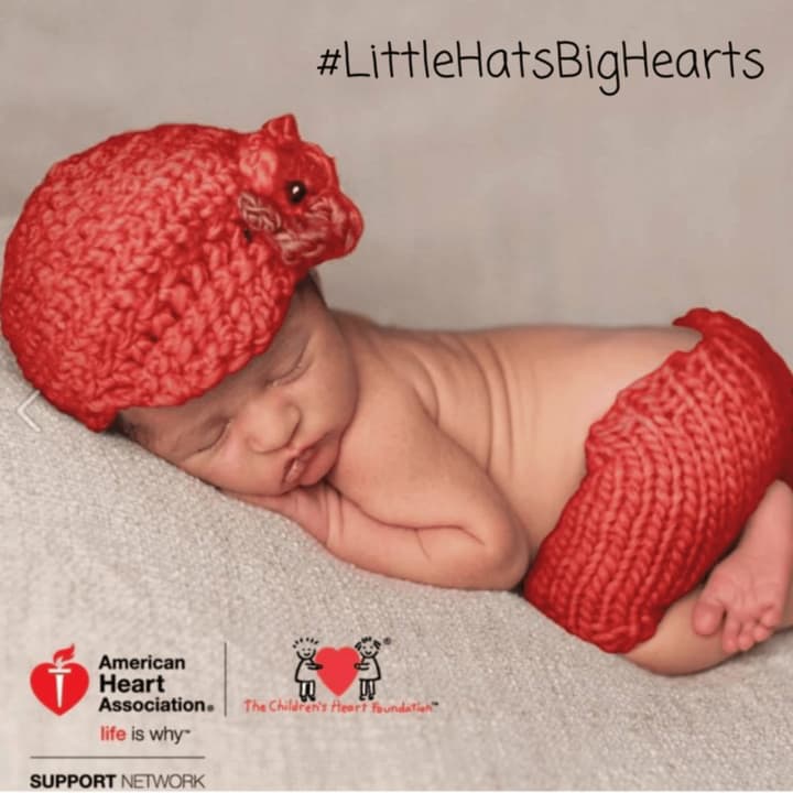 The American Heart Association, along with 26 hospitals in New York&#x27;s Hudson Valley and in western Connecticut, are joining the &quot;Little Hats Big Hearts&quot; drive to raise awareness of congenital heart defects.