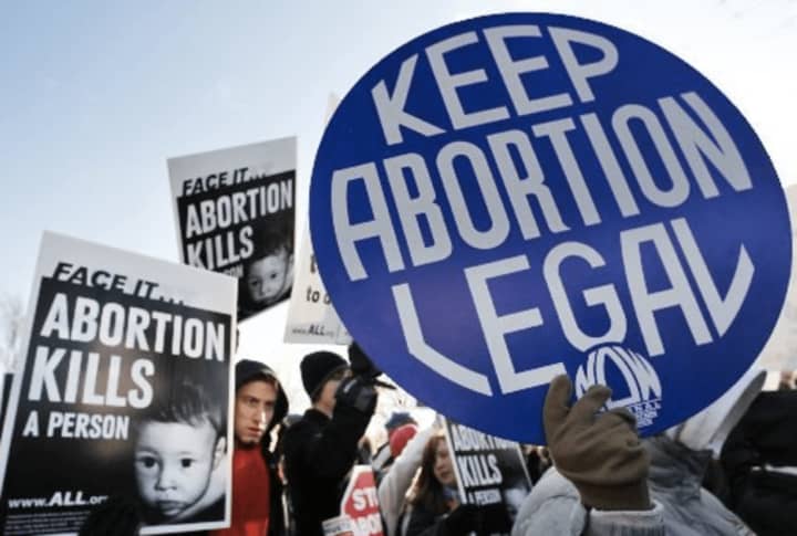 Thousand of people protested the Supreme Court&#x27;s decision to overturn Roe v. Wade on Friday. There are more protests planned across the country this weekend.