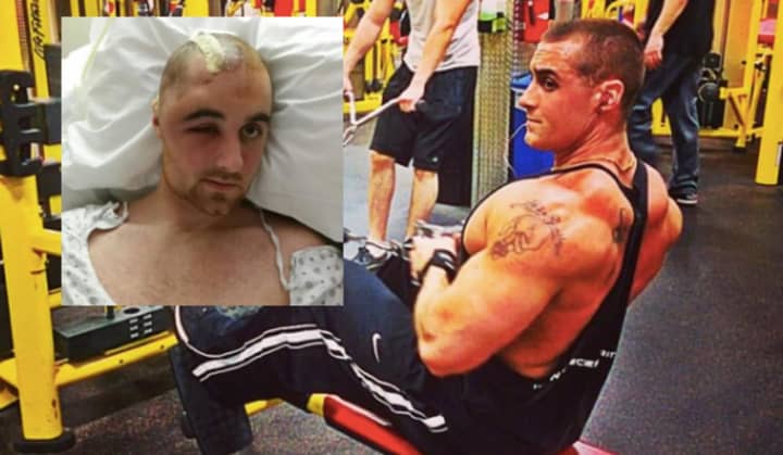 James Shanahan of Ridgefield Park, formerly a personal trainer at Retro Fitness Hackensack, says his steroid used caused a stroke in 2015. &quot;I wanted to be as strong as I possibly could,&quot; he said. &quot;But it was never enough.&quot;