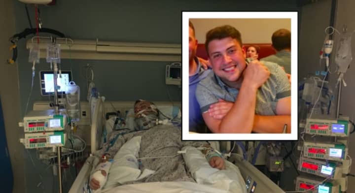 Cody Diorio was hospitalized with severe head trauma after falling down the stairs at a friend&#x27;s house.