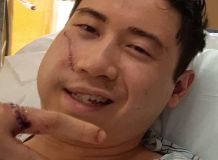 The Somerset County community is coming together to support 24-year-old Kelvin Lee, who was critically injured defending his friend from a cold and calculated knife attack by a vengeful ex.