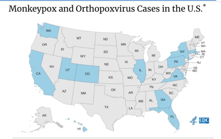 A look at states with confirmed cases of monkeypox (in blue). New York has the most cases with seven.