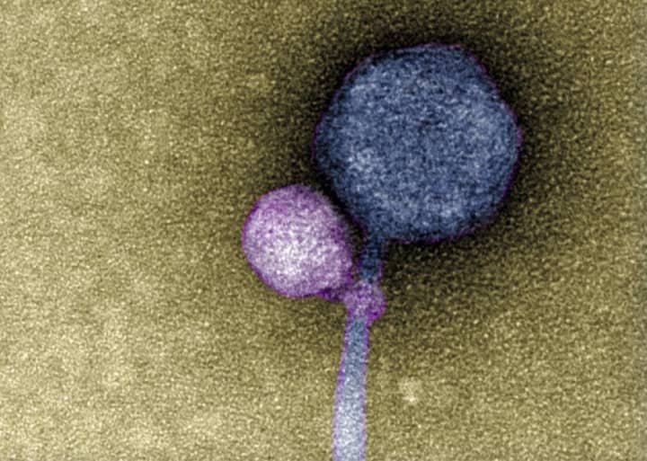 The newly discovered satellite virus latched onto its helper virus in an image by professor Tagide deCarvalho of the University of Maryland-Baltimore County.