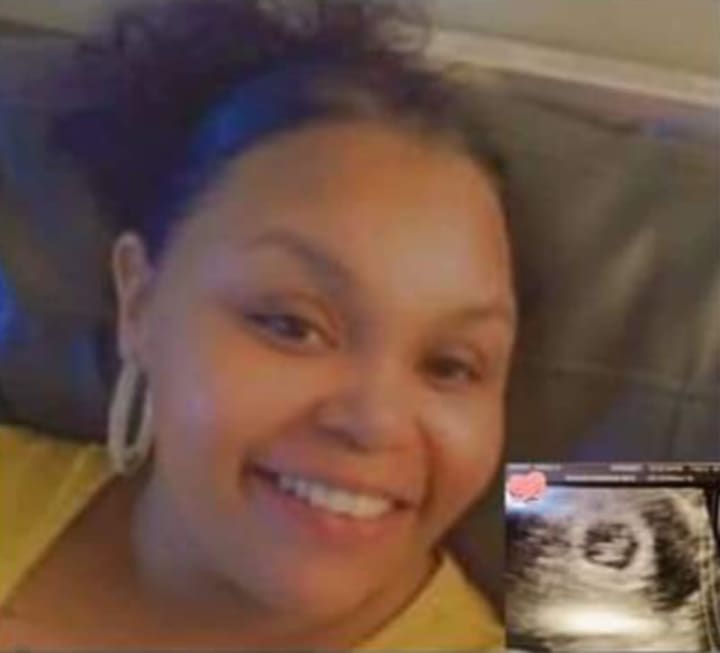 Karli Short and a sonogram of her unborn child.