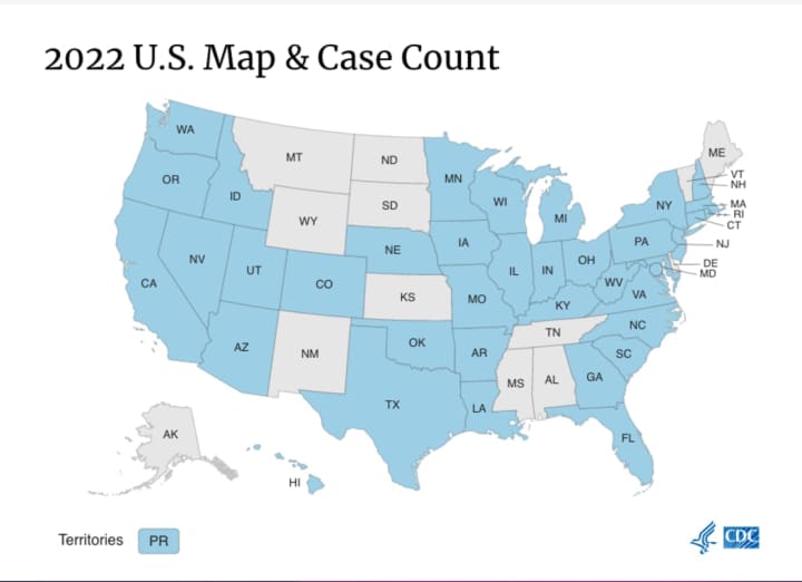 The Centers for Disease Control and Prevention (CDC) has released a rundown of cases by state.