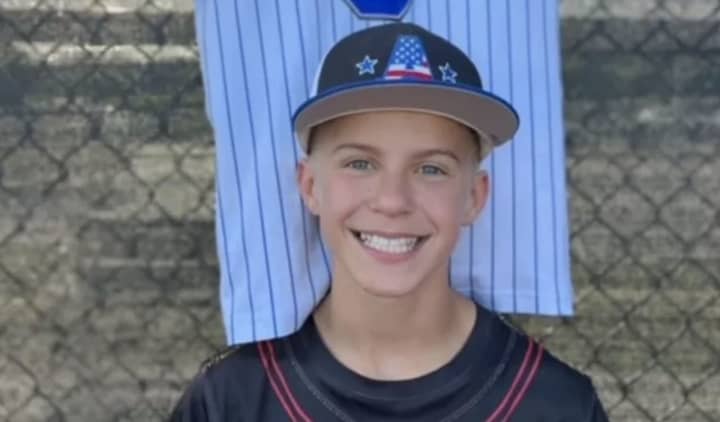 Cam St. Francis is recovering from a broken orbital bone and a severe concussion from an accident while playing at a baseball field in Auburn earlier this month. Since then, his mother said, several people have stepped up to help.