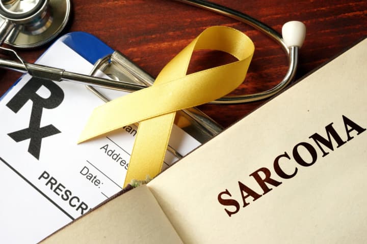 Rare but dangerous, sarcoma is often easiest to treat in its early stages.