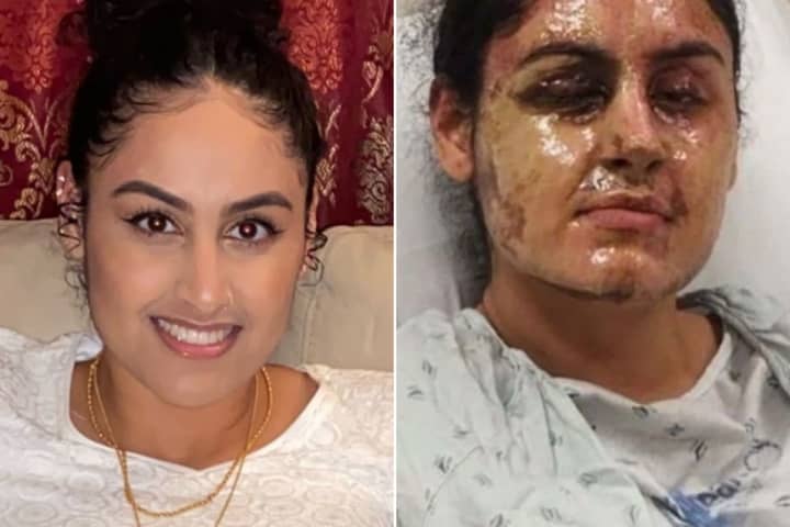 Nassau County is raising the reward to $50,000 for information leading to the person who threw acid on Hofstra University student Nafiah Ikram outside her Elmont home in March 2021.