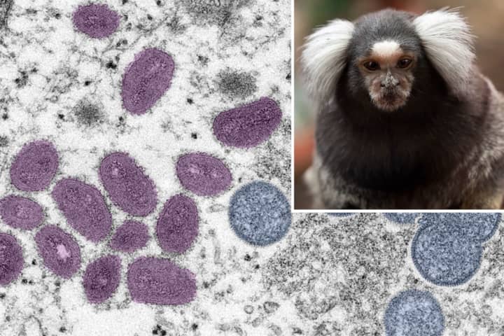 The World Health Organization is reporting an increase in attacks on monkeys amid the growing monkeypox outbreak.