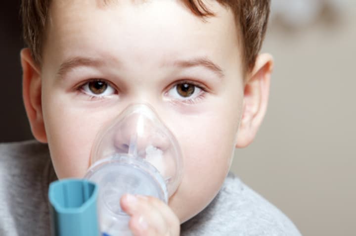 Northern Westchester Hospital Pediatric Pulmonologist focuses on managing childhood asthma.