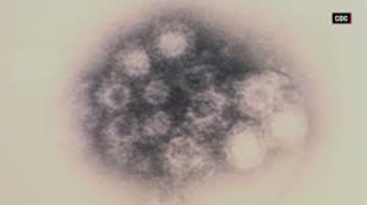 An image of the EV-68 virus.