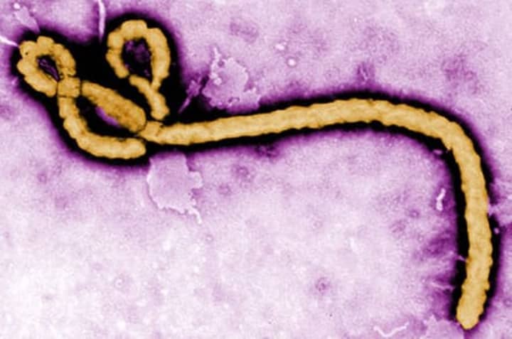 IBM has launched initiatives to help curb the spread of Ebola.