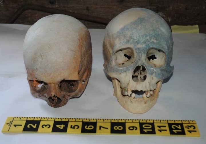Stamford Police are searching for the answer behind two human skulls left behind in the trash at the city&#x27;s transfer station on Thursday.