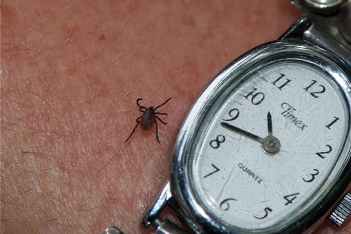 The black-legged tick, more commonly known as the deer tick, is known for transferring Powassan Virus