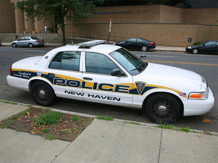 The severed legs found July 15 near a New Haven Metro-North train station have been identifed as belonging to a homeless man.