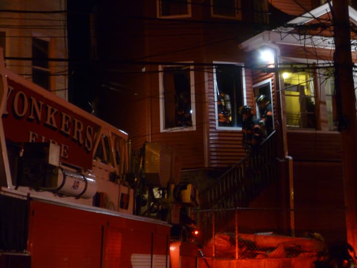 An 8-month old baby was hospitalized after suffering second-degree burns to the face during a Tuesday night blaze in Yonkers. 