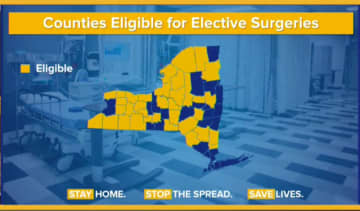 A look at counties (in yellow) now cleared to resume performing elective surgeries.