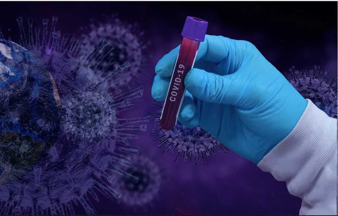 COVID-19 positive test