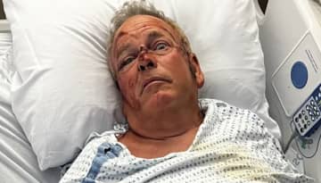 Yorktown resident Ed Moffett was severely injured after he was run over by an ATV at a baseball field.