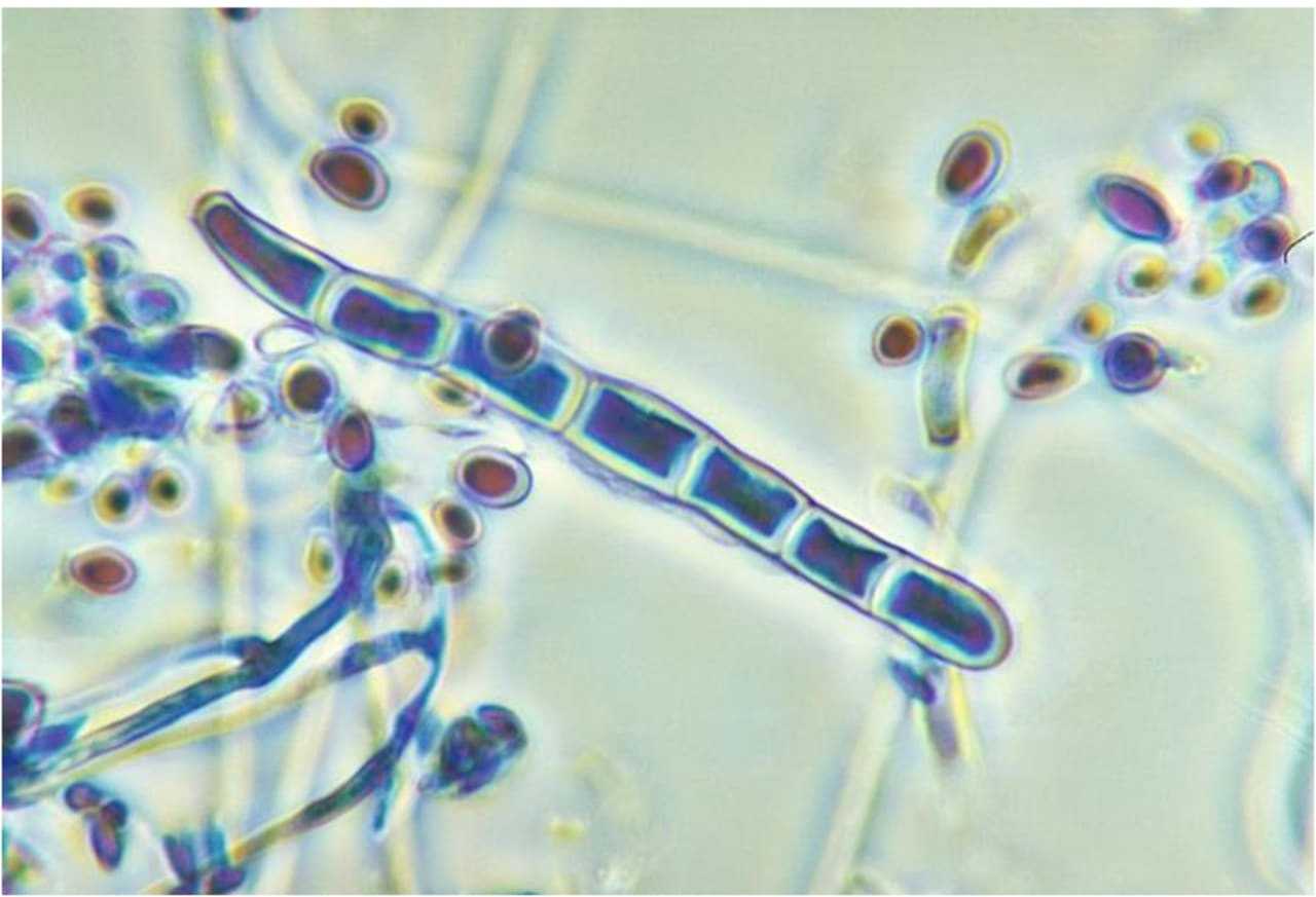 The Trichophyton fungus.